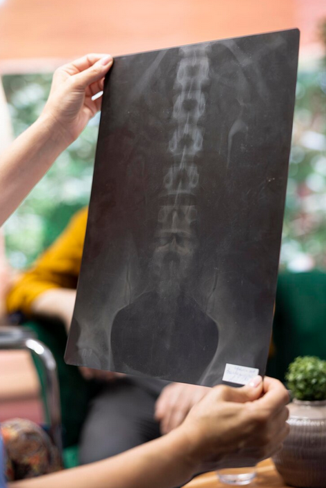 كيف يتم تشخيص التهاب الفقرات التصلبي؟